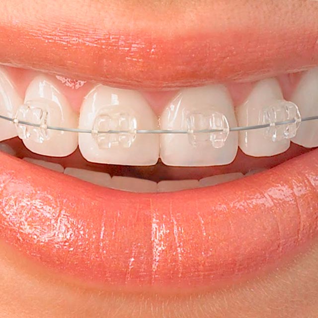 Clínica Dental Manuel Marín - Ortodoncia