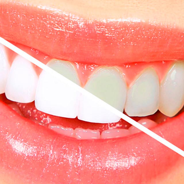 Clínica Dental Manuel Marín - Estética dental