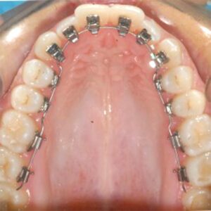 Clínica Dental Manuel Marín - Ortodoncia
