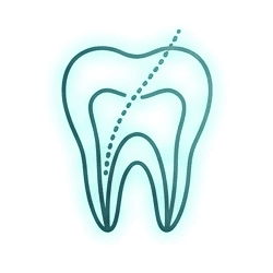 Clínica Dental Manuel Marín - Endodoncia