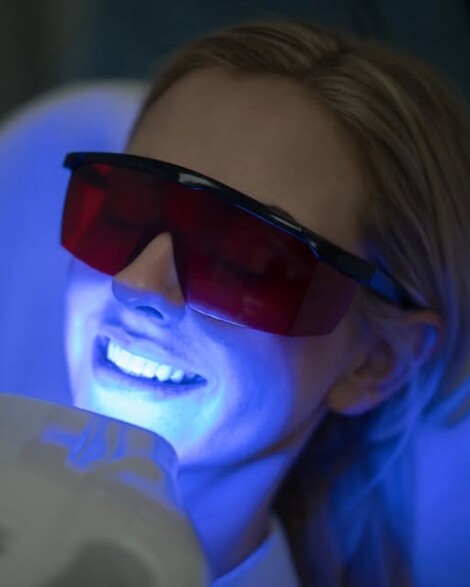 Clínica Dental Manuel Marín - blanqueamiento-dental