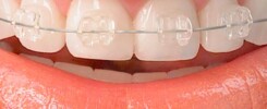 Clínica Dental Manuel Marín - Ortodoncia