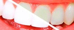 Clínica Dental Manuel Marín - Estética dental
