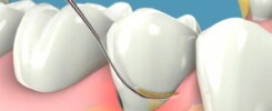 Clínica Dental Manuel Marín - Periodoncia