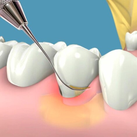 Clínica Dental Manuel Marín - Periodoncia