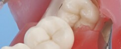 Clínica Dental Manuel Marín - Cirugía