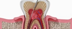 Clínica Dental Manuel Marín - Endodoncia